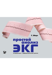 Простой анализ ЭКГ. Интерпретация. Дифференциальный диагноз