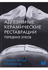 Адгезивные керамические реставрации передних зубов