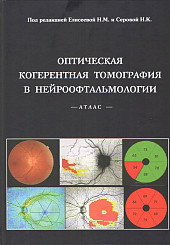 Оптическая когерентная томография в нейроофтальмологии. Атлас
