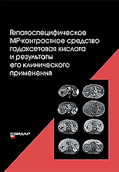 Гепатоспецифическое МР-контрастное средство "гадоксетовая кислота" и орезультаты его клинического применения

