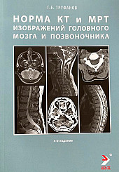 Норма КТ-и МРТ-изображений головного мозга и позвоночника 
