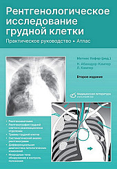 Рентгенологическое исследование грудной клетки. Практическое руководство. Атлас. Второе издание