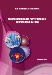 Лапароскопическая гистерэктомия: современный взгляд
