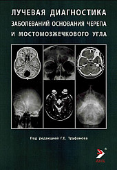 Лучевая диагностика заболеваний основания черепа и мостомозжечкового угла. Учебное пособие