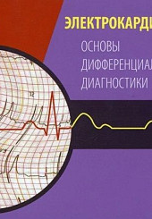 Электрокардиограмма: основы дифференциальной диагностики