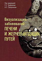 Визуализация заболеваний печении желчевыводящих путей. Учебное пособие