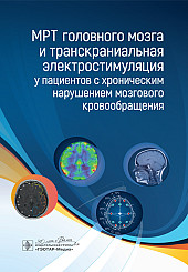 МРТ головного мозга и транскраниальная электростимуляция у пациентов с хроническим нарушением мозгового кровообращения