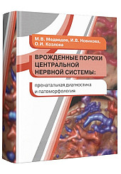 Врожденные пороки центральной нервной системы. Пренатальная диагностика и патоморфология
