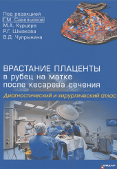 Врастание плаценты в рубец на матке после кесарева сечения. Диагностический и хирургический атлас