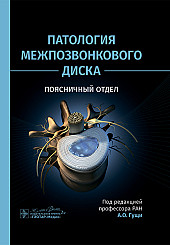 Патология межпозвонкового диска. Поясничный отдел