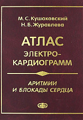Аритмии и блокады сердца: атлас электрокардиограмм							
