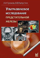 Ультразвуковое исследование предстательной железы