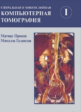 Спиральная и многослойная компьютерная томография в 2-х томах  т. 1.