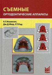 Съемные ортодонтические аппараты