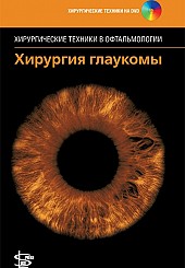 Хирургия глаукомы. Серия "Хирургические техники в офтальмологии"