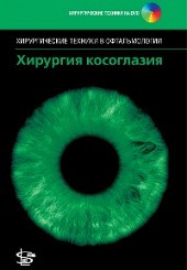 Хирургия косоглазия+DVD. Серия "Хирургические техники в офтальмологии"