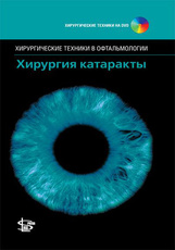 Хирургия катаракты+DVD. Серия "Хирургические техники в офтальмологии"
