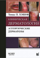 Клиническая дерматология. Аллергические дерматозы