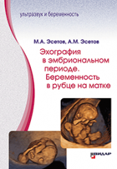 Эхография в эмбриональном периоде. Беременность в рубце на матке.
