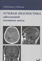 Лучевая диагностика заболеваний головного мозга. 3-е издание
