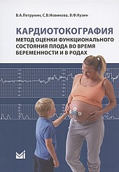 Кардиотокография – метод оценки функционального состояния плода во время беременности и в родах