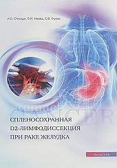 Спленосохранная D2-лимфодиссекция при раке желудка