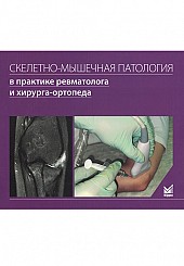 Скелетно-мышечная патология в практике ревматолога и хирурга-ортопеда: краткое иллюстрированное руководство