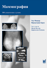 Маммография. 100 клинических случаев