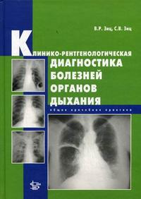 Клинико-рентгенологическая диагностика болезней органов дыхания: общая врачебная практика