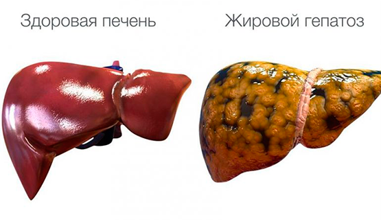 img-1